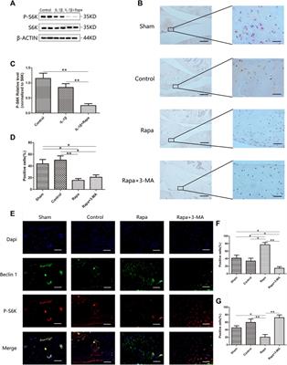 Enhancing autophagy and energy metabolism in the meniscus can delay the occurrence of PTOA in ACLT rat